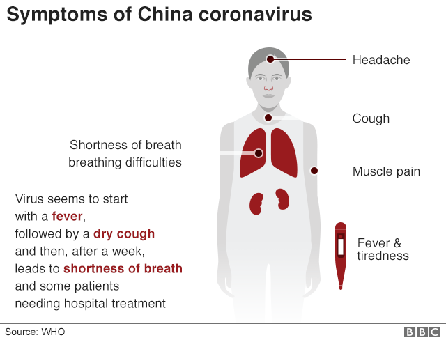 Virus corona: Những triệu chứng và cách phòng tránh cần biết